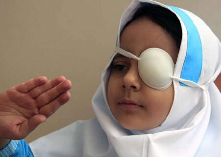تنبلی چشم در فامنین، ۳۵ کودک را گرفتار کرد