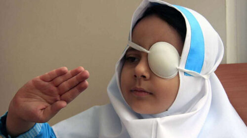 تنبلی چشم در فامنین، ۳۵ کودک را گرفتار کرد